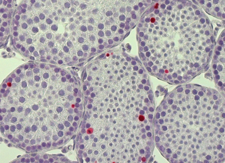 Coupe de de testicule de souris avec détection des cellules en apoptose (mort cellulaire) par méthode TUNEL